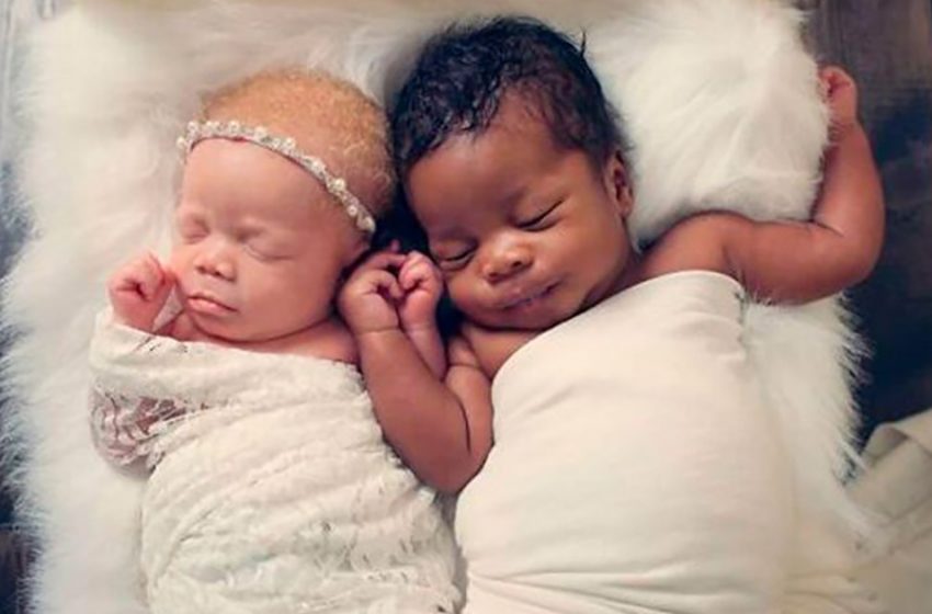  L’histoire des jumeaux noirs et blancs : comment se présentent les frères et sœurs de différentes couleurs ?