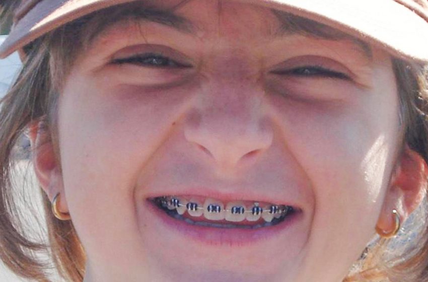  “Je suis un sur un million.” La fille s’est réveillée en tant que star d’Instagram après des chirurgies plastiques