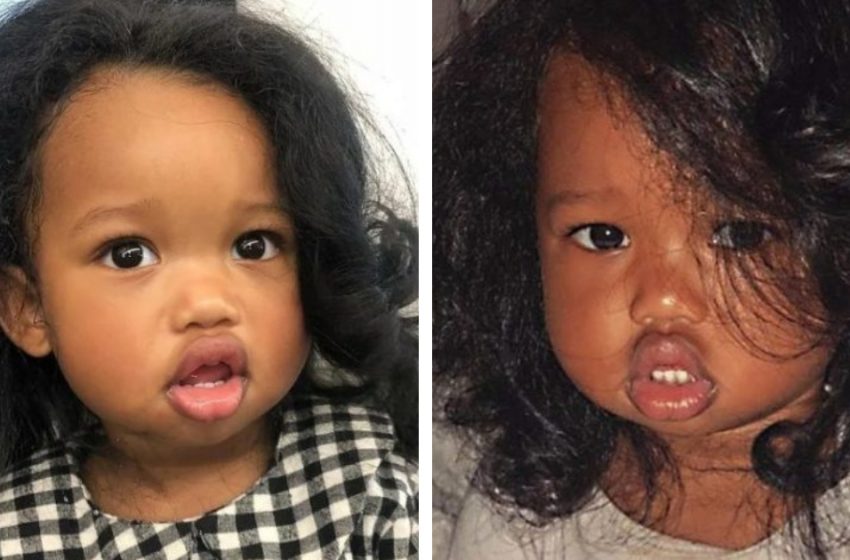  Ce bébé est devenu célèbre dans le monde entier grâce à ses lèvres les plus pulpeuses : voici à quoi elle ressemble maintenant