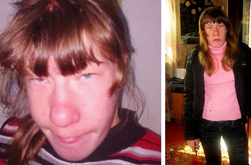  L’apparence de cette jeune femme a fait rire tout internet, mais elle a changé et prouvé à tous qu’ils avaient tort