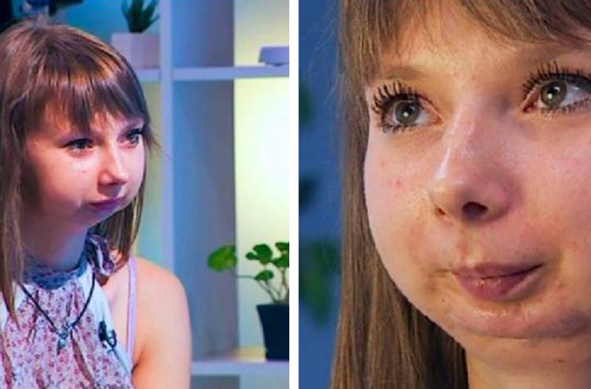  Quel a été le destin de la jeune fille dont la partie inférieure du visage a pu être restaurée par des médecins