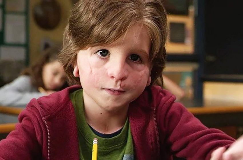  ‘Difficile à reconnaître sans maquillage’: à quoi ressemble l’acteur qui a joué le garçon Auggie dans ‘Miracle’ aujourd’hui