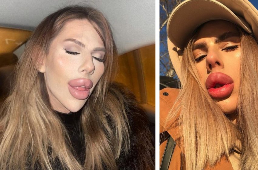  De garçon ordinaire à je-ne-sais-quoi: à quoi ressemblait le coiffeur de province avant la chirurgie plastique et la transformation