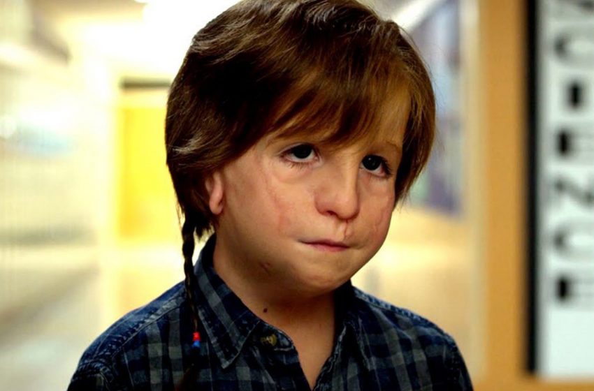  Sans maquillage, on ne le reconnaît tout simplement pas : voici à quoi ressemble maintenant l’acteur qui a joué Auggie dans “Miracle”.