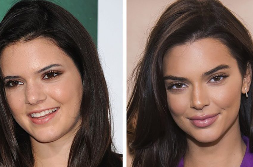  Célébrités devenues populaires grâce à la chirurgie plastique