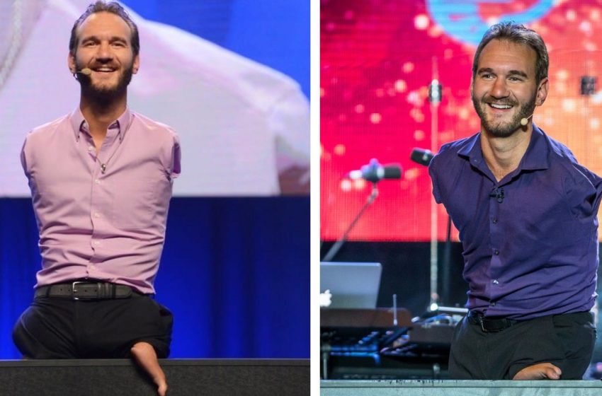  “Surprenant le monde chaque jour !” : L’influenceur australien sans tous ses membres a montré ses enfants adultes