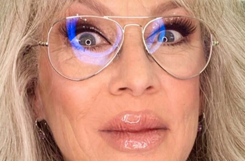  Hollywoodin legenda yllättää fanit dramaattisesti ylitäytetyillä huulilla ja rohkealla uudella lookilla!